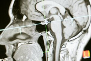 Brain Scan